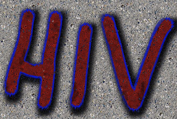 Nature子刊：AAV<font color="red">病毒基因治疗</font>艾滋病的首次临床试验结果公布