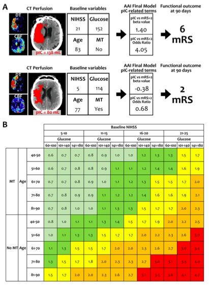 European Radiology：CT<font color="red">灌注</font>预测的梗死核心与急性卒中临床结果之间的关系