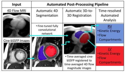 European Radiology：使用深度学习双心室分割的全自动4D血流MRI后处理