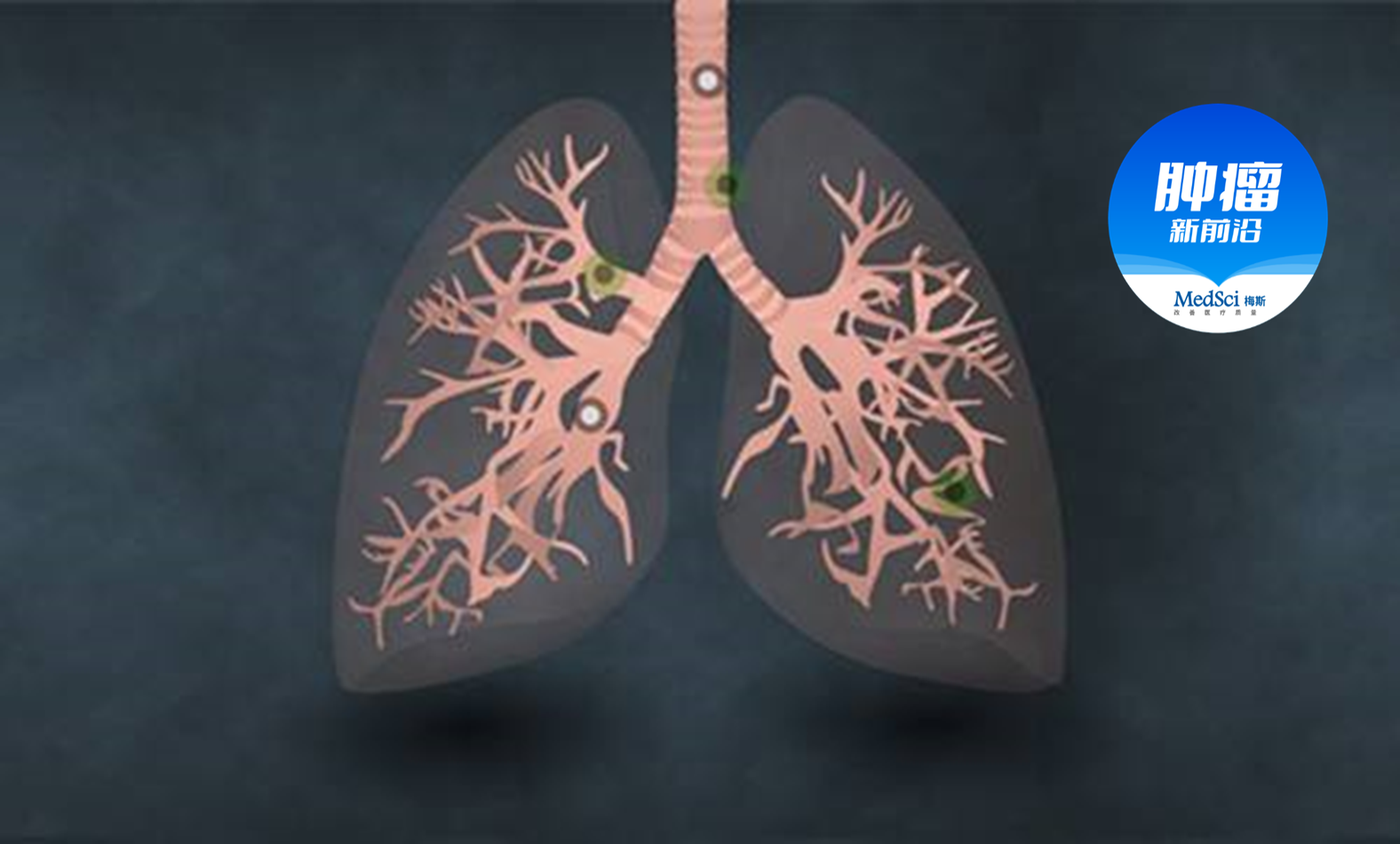 非小细胞肺癌的经典化疗方案系列研究汇总