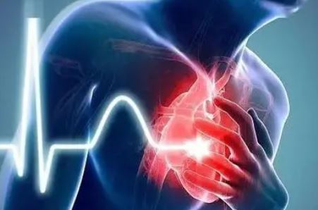 JAMA Cardiol：急性心肌梗死患者的10年生存率