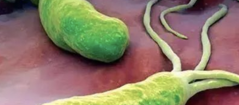 ASCO 2022 | 幽门螺杆菌感染与胰腺癌之间呈正相关