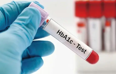 Cardiovasc Diabetol：HbA1c水平有助于预测重症监护室患者的死亡风险