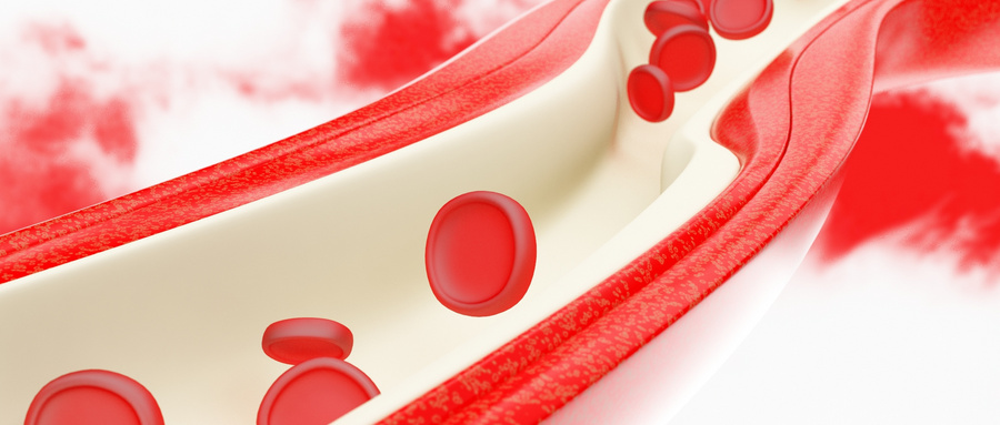 European Radiology：<font color="red">血管</font>内重建术在急性肠系膜动脉缺血中的应用
