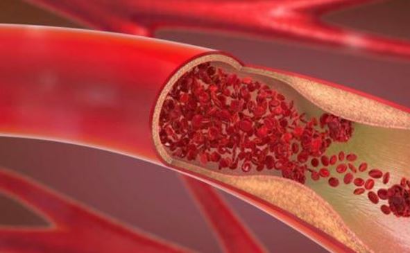 Cardiovasc Diabetol：血管活性肽ET-1和ADM与<font color="red">糖尿病</font>风险的相关<font color="red">性</font>