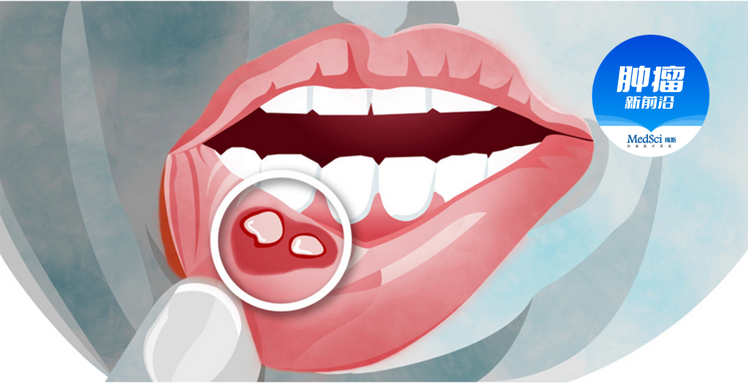 如何预防和治疗抗肿瘤治疗引起的口腔<font color="red">黏膜炎</font>？