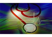 Circulation：<font color="red">极端</font>高温与心血管死亡率的关系