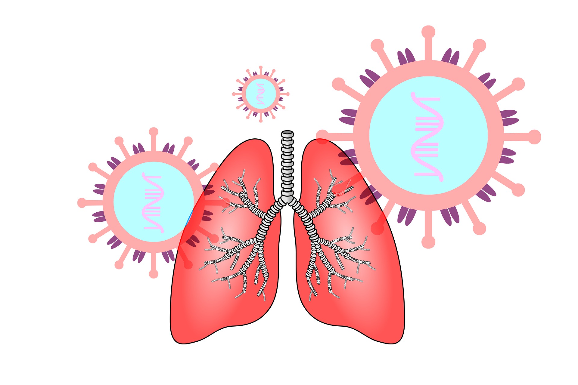 Allergy：重度哮喘T2生物标志物与微生物组成