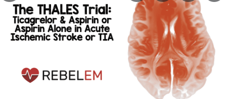 Neurology：替格瑞洛和阿司匹林在急性缺血性中风或TIA30天显示出显著获益