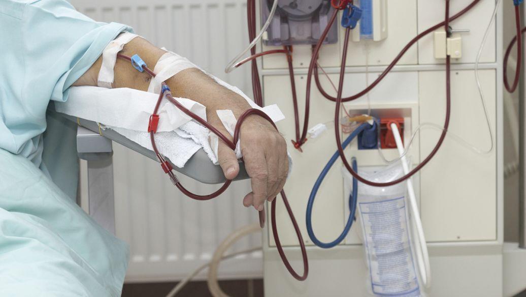 J Healthc Eng：高通量血液透析对慢性肾功能衰竭患者慢性炎症、抗氧化能力、体温和免疫功能的影响