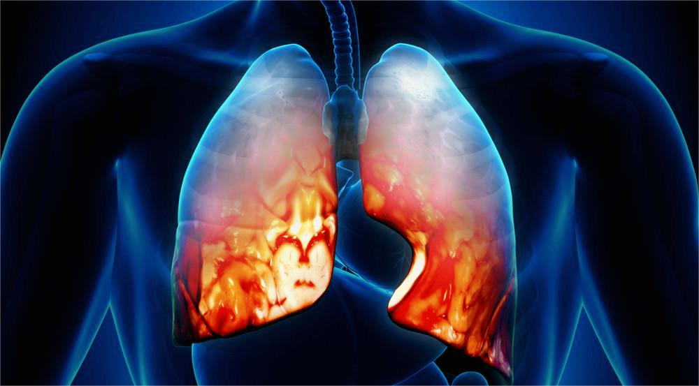 J Ethnopharmacol：清肺口服液通过Akt信号通路促进脂肪酸依赖性M1/M2巨噬细胞极化，减轻RSV诱导的肺部炎症