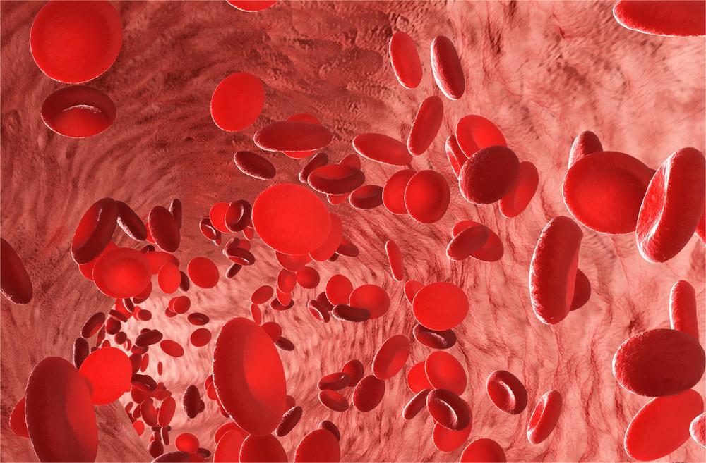 Rheumatology：<font color="red">扩展</font><font color="red">超声</font>检查发现巨细胞动脉炎患者更大血管受累