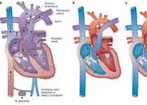 Eur Heart J：恩格列净对心力衰竭患者循环蛋白质<font color="red">组</font><font color="red">学</font>的影响