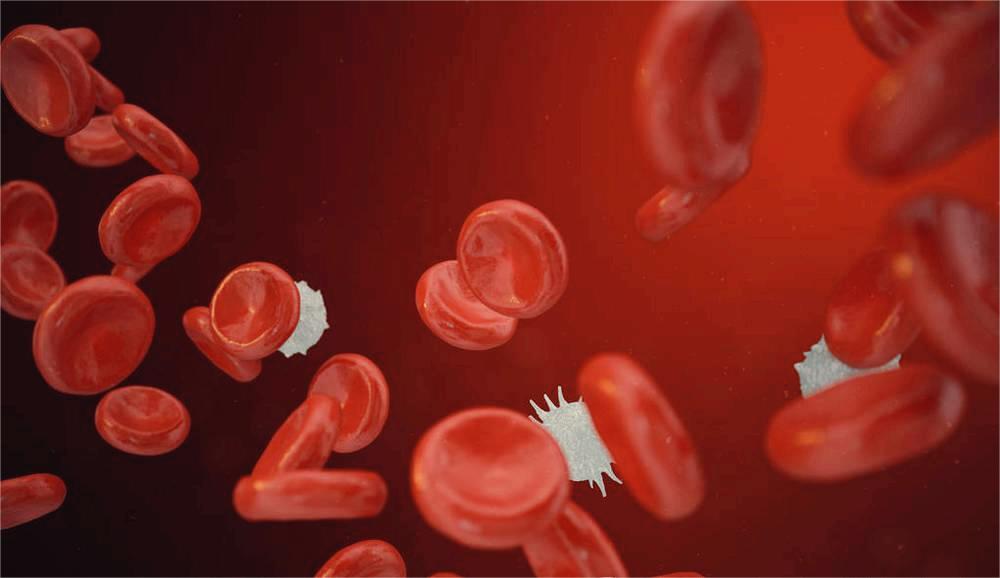 A&R：中性粒细胞-淋巴细胞比率和血小板-淋巴细胞比率可作为中轴型脊柱炎的生物标志物