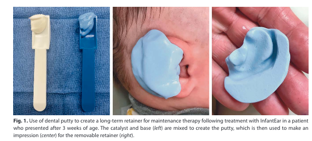 PRS：10年回顾性研究揭示婴儿耳再造技术的演变