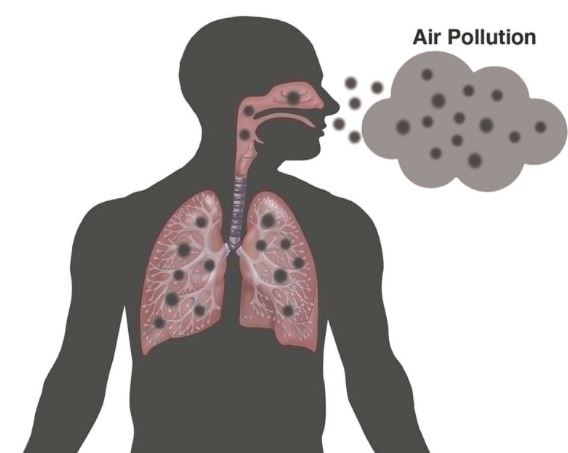 JACC：空气污染与心肌缺血患者的<font color="red">冠状动脉</font>舒缩障碍相关