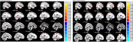 Neural Regen Res：复发-缓解型多发性硬化症的海马结构、功能<font color="red">连接</font>与认知功能、残疾程度有关
