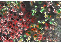 Nature：张宁/张泽民/朱继业合作揭示肝癌免疫微环境亚型和中性<font color="red">粒细胞</font>异质性