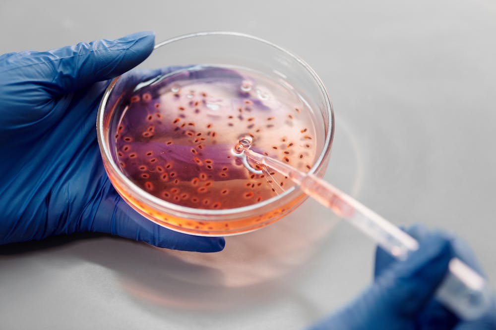 隐球菌荚膜多糖抗原检测试剂注册技术审查指导原则