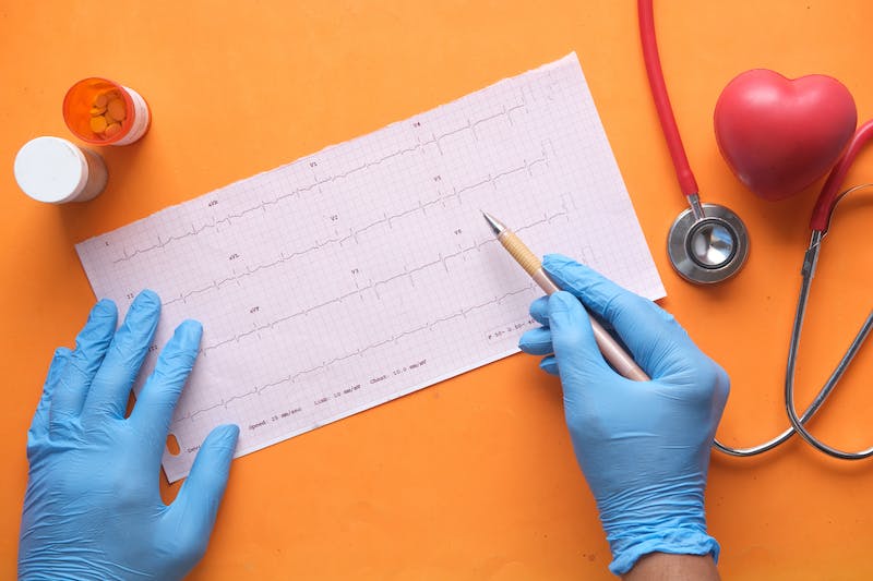 心室预激合并心房颤动的心电图如何分析？怎么处理？