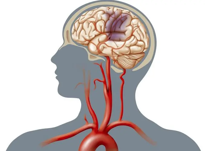 JCBFM：利用高分辨率MRI研究健康志愿者中磺脲类药物对脑血管的影响