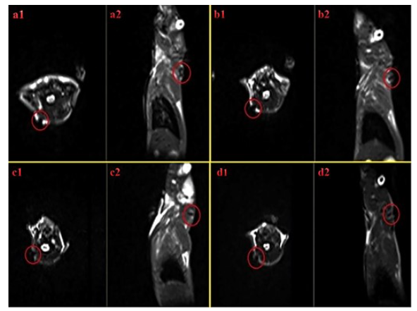 Bunrs & Trauma：MRI追踪烧伤创面超顺磁性氧化铁纳米粒标记脱细胞真皮基质上的人脐带沃顿胶干细胞
