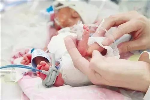 BMJ子刊：“生存阈值”出生的婴儿发生坏死性小肠结肠炎(NEC)的结局