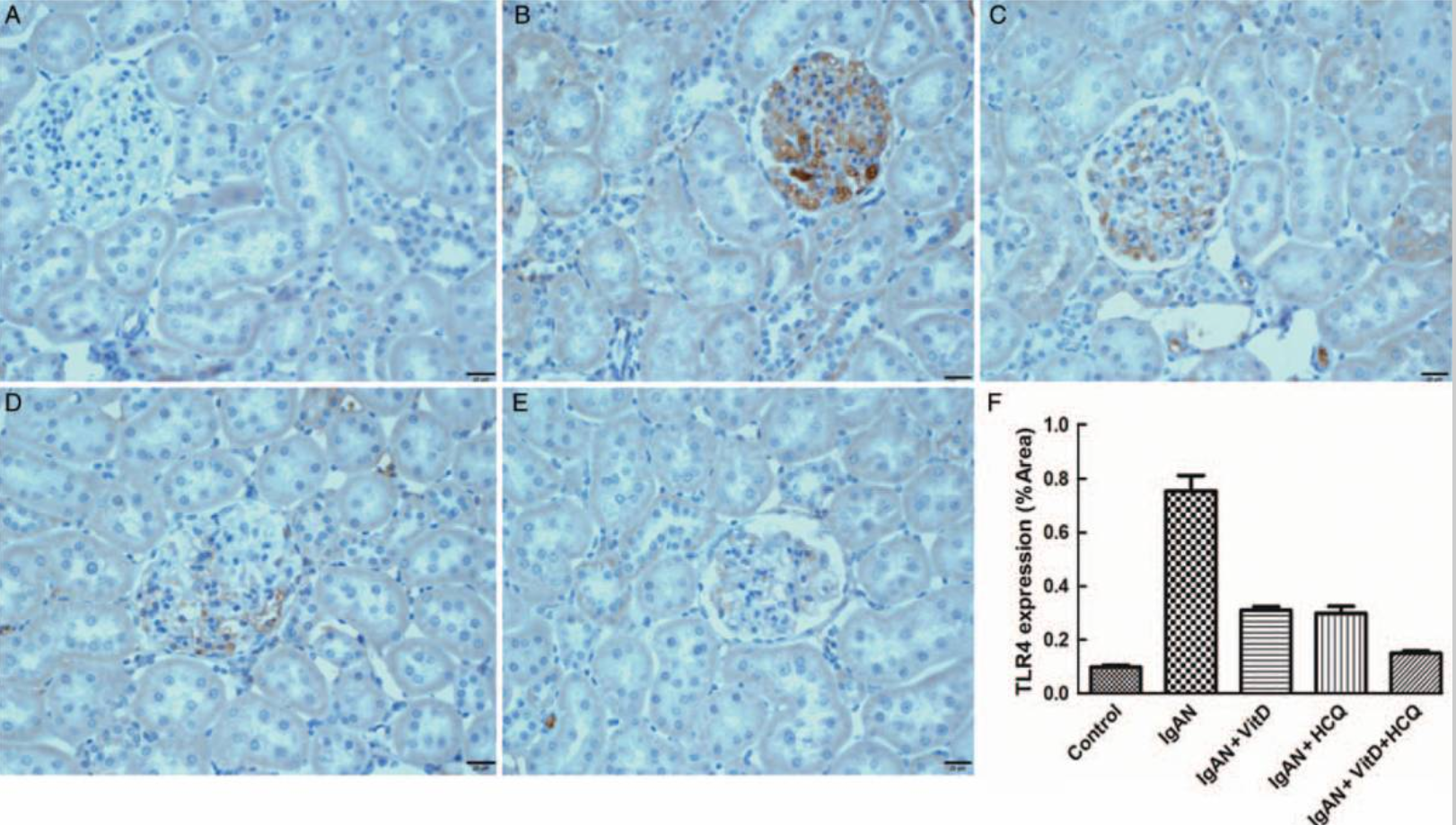 维生素D和羟氯喹通过TLR4减少IgA肾病大鼠模型中的肾损伤和<font color="red">Ki67</font>表达