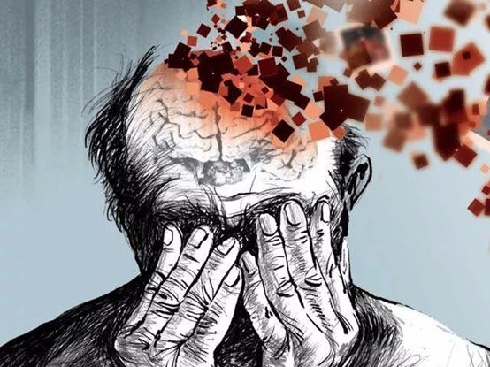Alzheimer's&Dementia：痴呆是COVID-19住院患者严重程度和死亡的危险因素