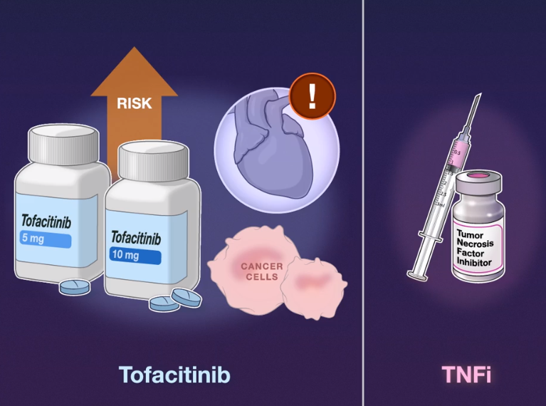 NEJM：托法替尼治疗的类风湿性关节炎患者心血管疾病和癌症风险
