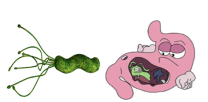 幽门螺杆菌感染与胃内菌群变化研究进展