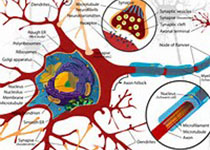 Neurology：<font color="red">双</font><font color="red">侧</font>对称性小脑中脚<font color="red">梗死</font>