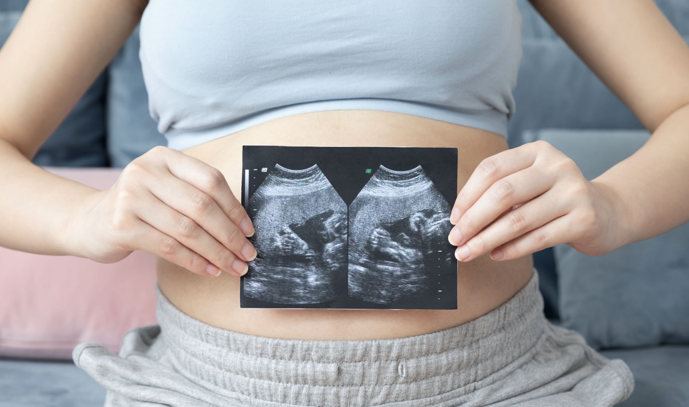 美国妇产科医师学会《多胎妊娠指南（2021版）》要点解读
