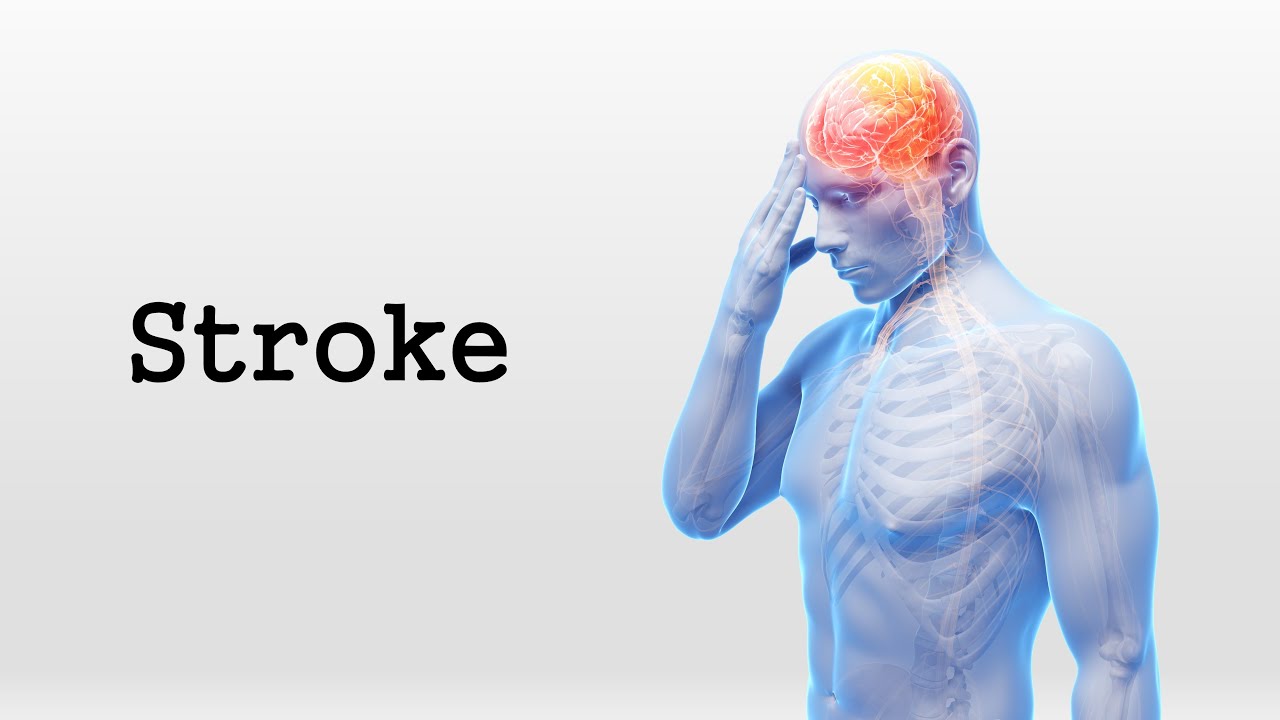 Stroke：脑中风患者，家人的死亡风险也会增加