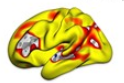  Cerebral Cortex：社会经济地位与认知能力之间的关系<font color="red">部分</font>与脑结构<font color="red">有关</font>