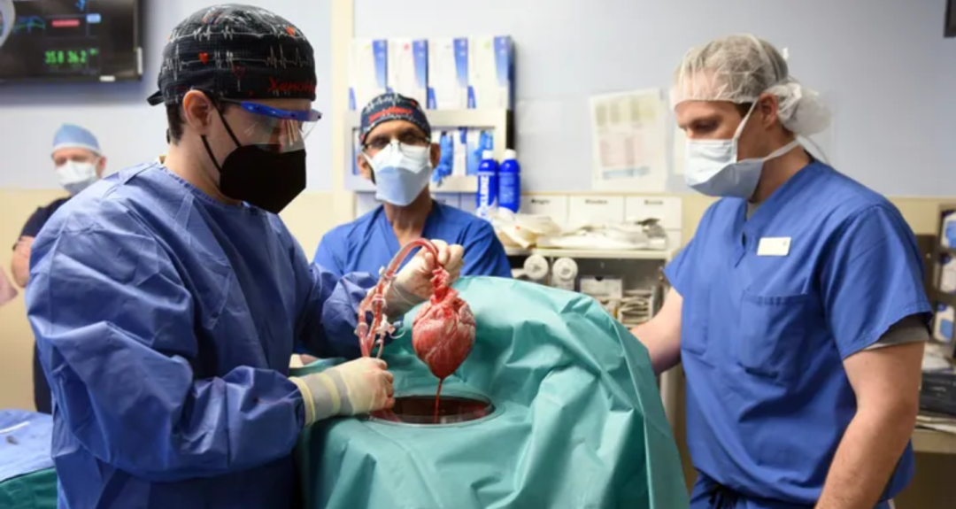  medRxiv：世界首例猪心脏移植患者去世，中国首例猪器官移植人体实验预计在今年开展