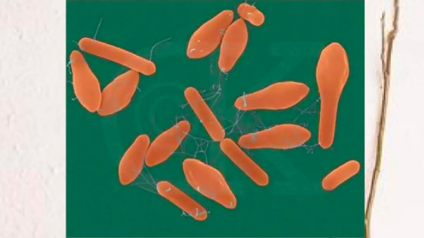 Cell：<font color="red">腹泻</font>、肠炎...这种病菌如何让你肚子疼？西湖大学Cell论文揭示其侵入人体的分子机制