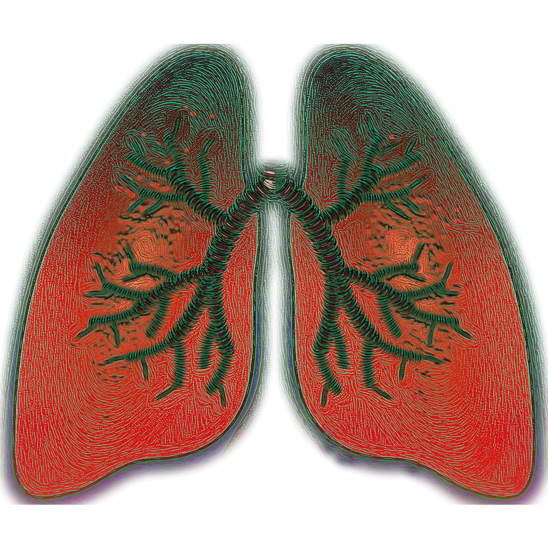 PAL：<font color="red">持续性</font>哮喘患者在儿童早期即出现肺功能受损