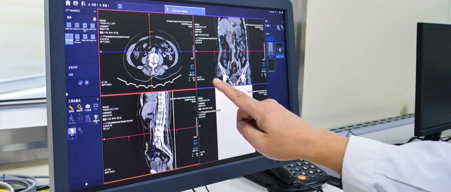 European Radiology：从影像学角度评估胰腺癌新辅助治疗后的肿瘤可切除性和治疗反应