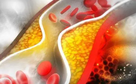 JAMA Oncol：卡罗妥昔单抗联合帕唑帕尼治疗晚期血管<font color="red">肉瘤</font>的疗效和安全性