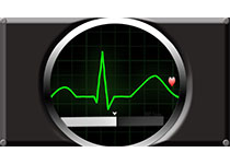 Circulation：氟卡尼降低室性心动过速患者心律失常事件发生率
