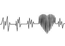 Eur Heart J：与心脏传导<font color="red">疾病相关</font>的生活习惯