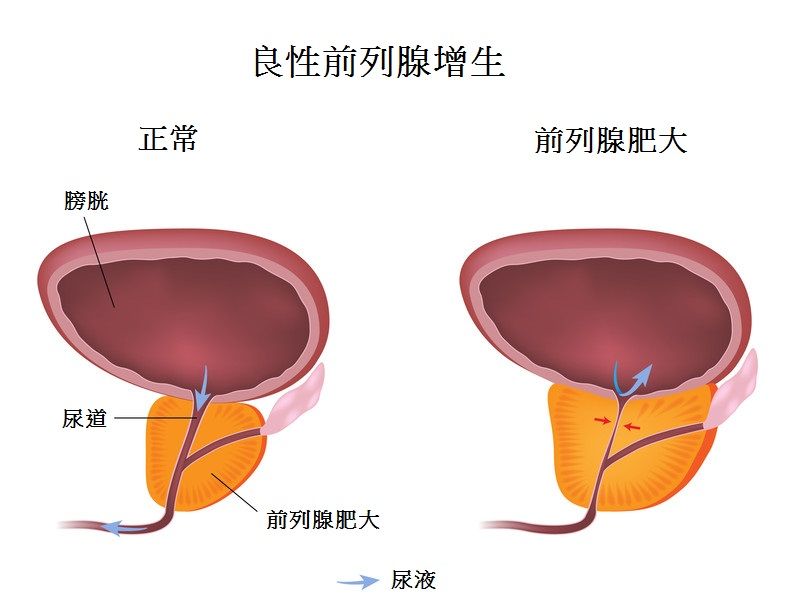 影像预警<font color="red">脑血管病</font>