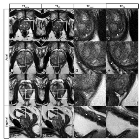 Investigative Radiology：如何实现前列腺MR图像的“又快又好”？