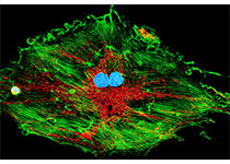 Nature Communications：王宏林/周斌合作揭示成纤维细胞介导炎性皮肤过度神经支配新机制