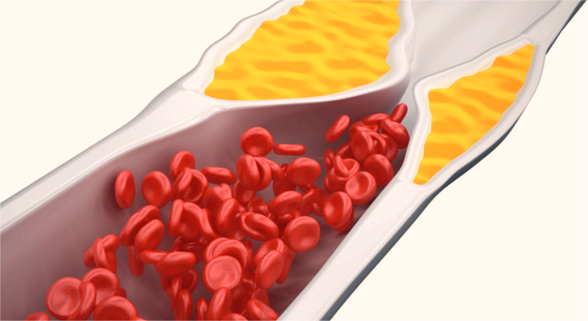 J Ethnopharmacol：<font color="red">栀子</font><font color="red">苷</font>通过血管周围脂肪细胞衍生的CXCL14调节巨噬细胞极化来改善动脉粥样硬化