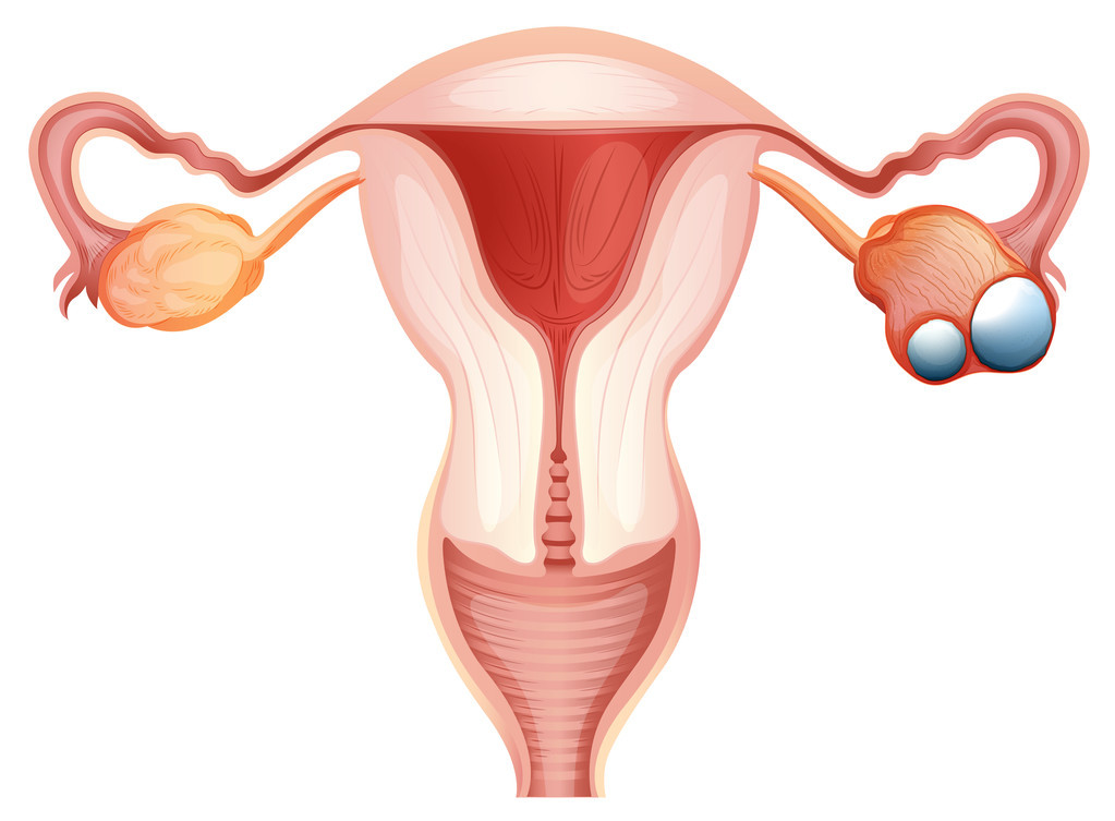 卵巢癌高复发因素有哪些？