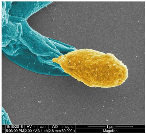 PNAS：科学家发现双效抗生素，可杀死艰难梭菌，防止再感染