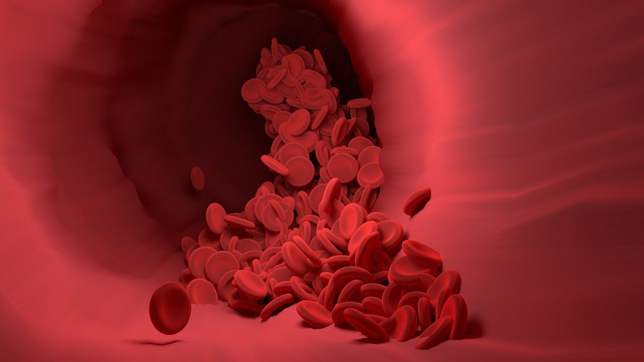 2023 BSH 指南：严重血红蛋白病<font color="red">的</font>筛查和诊断