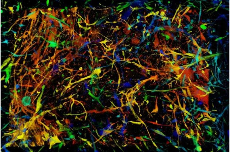 研究发现清除衰老细胞可改变脑<font color="red">胶质瘤</font>的生态系统并延缓其进展